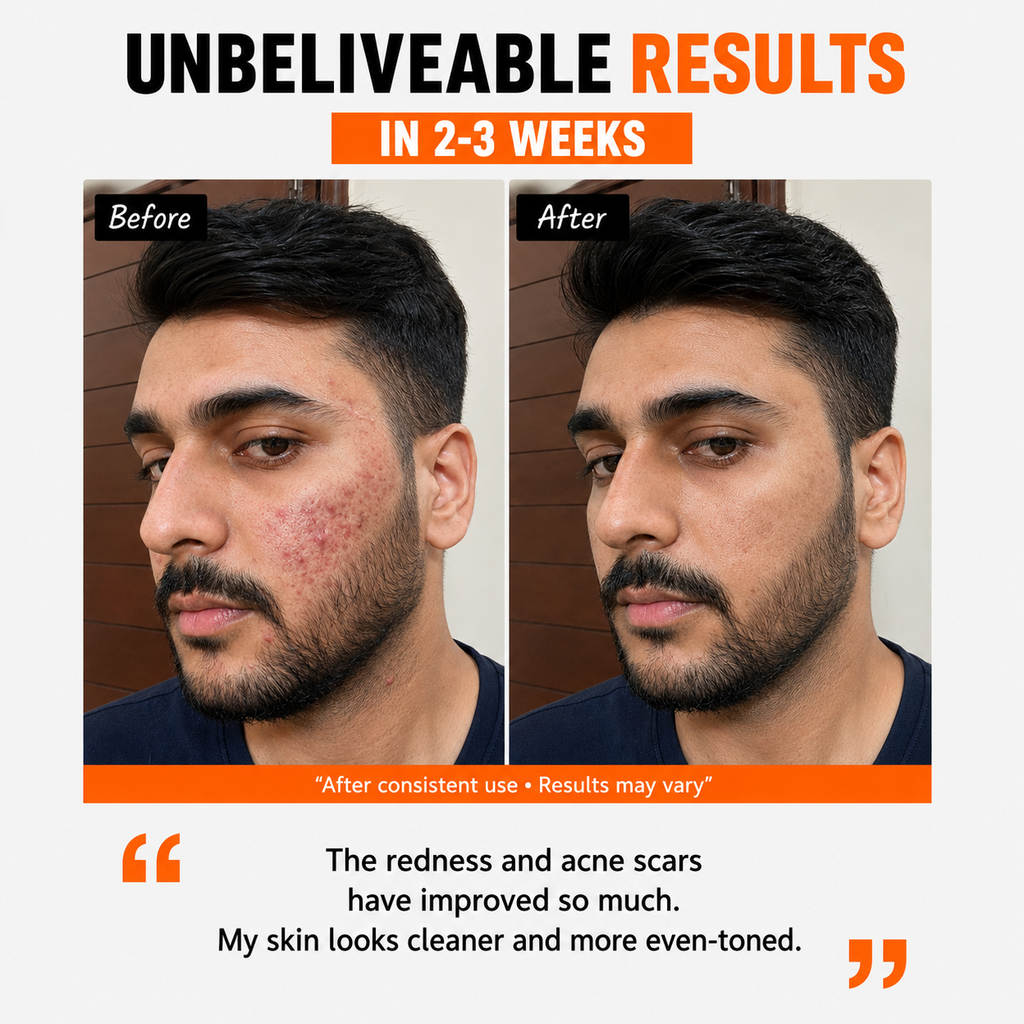 Zebe Retinol Serum – Advanced Skin Repair for Men
