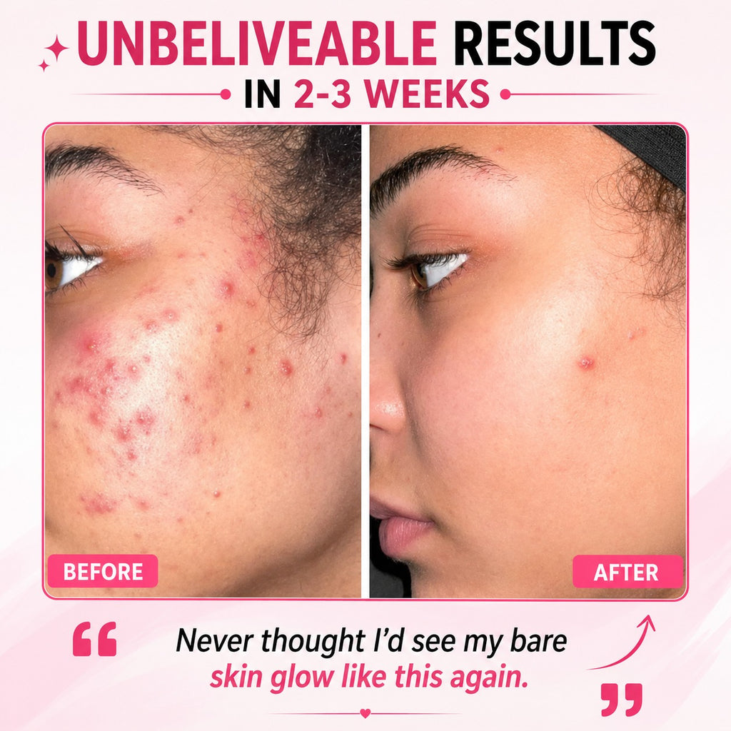 Zebe 1% Retinol Serum – For Smooth, Radiant & Youthful Skin