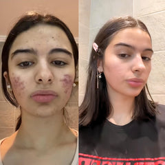 Glass Skin Combo (CE Ferulic Serum + Brightening Booster Facewash)