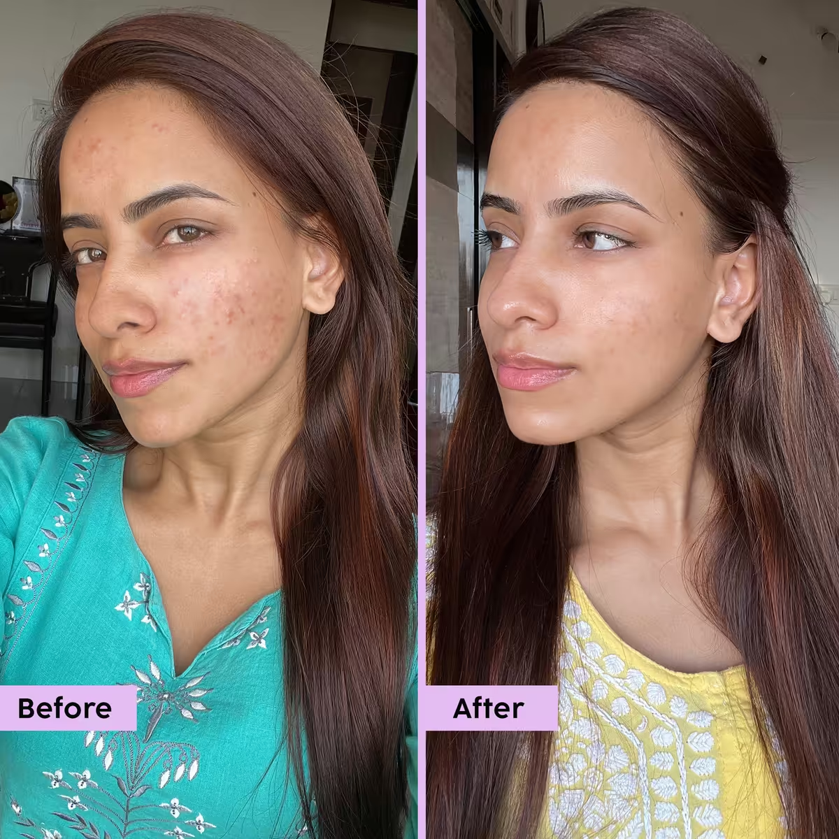 RETINOL SERUM Turn Back Time. Wake Up to Younger-Looking Skin Every Day.