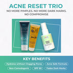 Acne Reset Clear Skin Trio