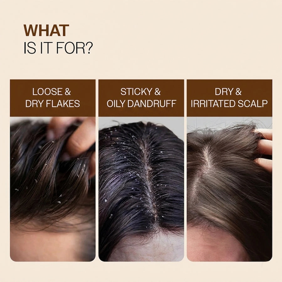 Pro Clear Anti-Dandruff Scalp Lotion (30ml)