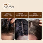 Pro Clear Anti-Dandruff Scalp Lotion (30ml)