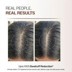 Pro Clear Anti-Dandruff Scalp Lotion (30ml)